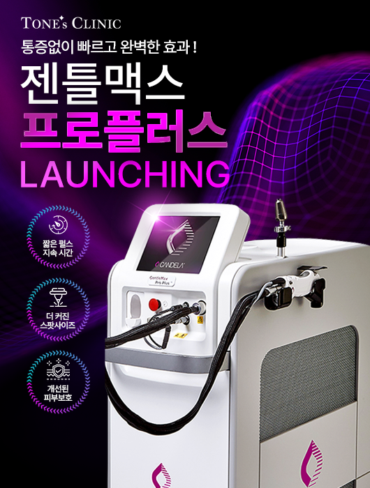 팝업
